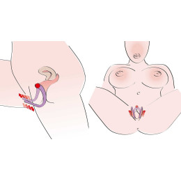 Стимулятор-расширитель точки G Labia Spreader